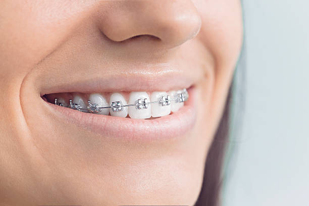 Laser Dentistry in Lawrenceburg, KY